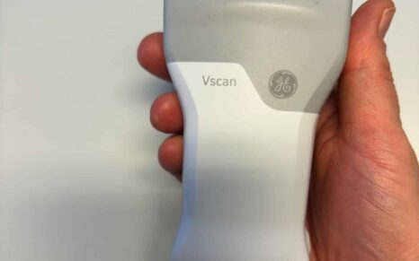 Bilde av hånd som holder ultralydapparat